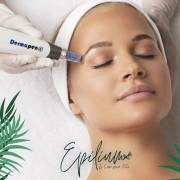 MICRONEEDLING AVEC DERMAPEN rabat