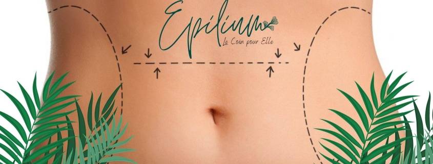 Se débarrasser de la cellulite Epilium