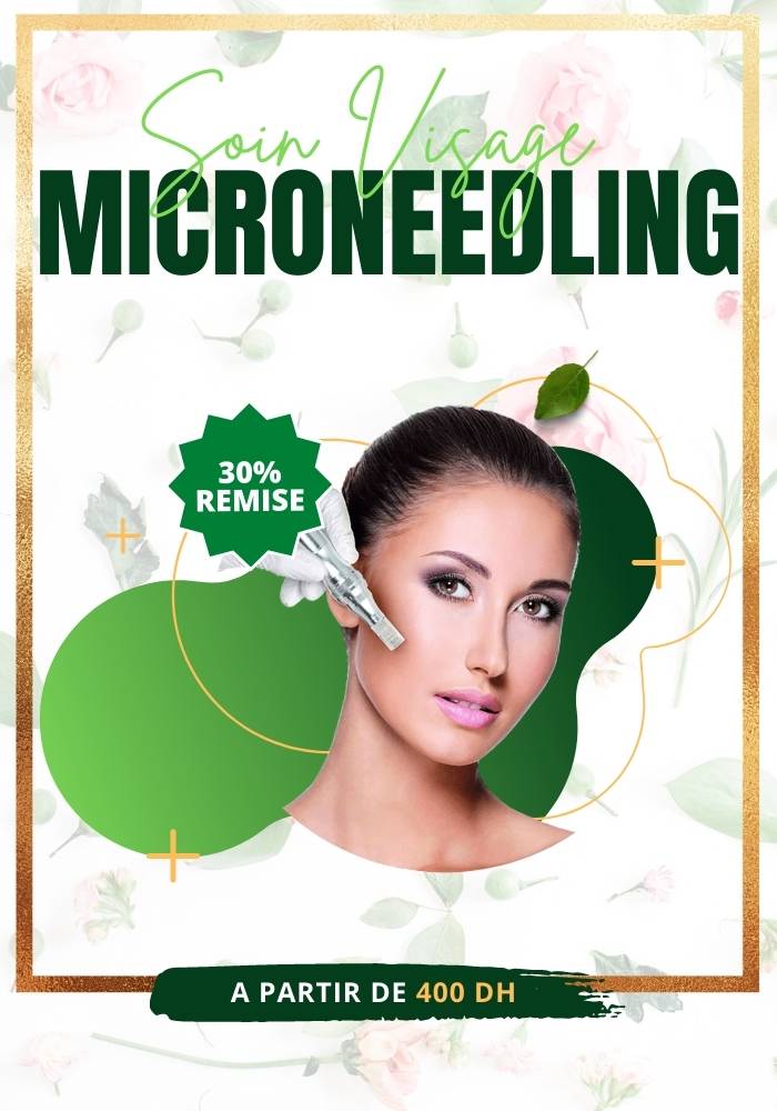 Microneedling rabat